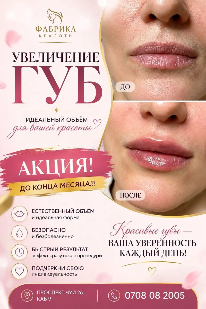 Контурная пластика губ гиалуроновым филлером. — фото 3