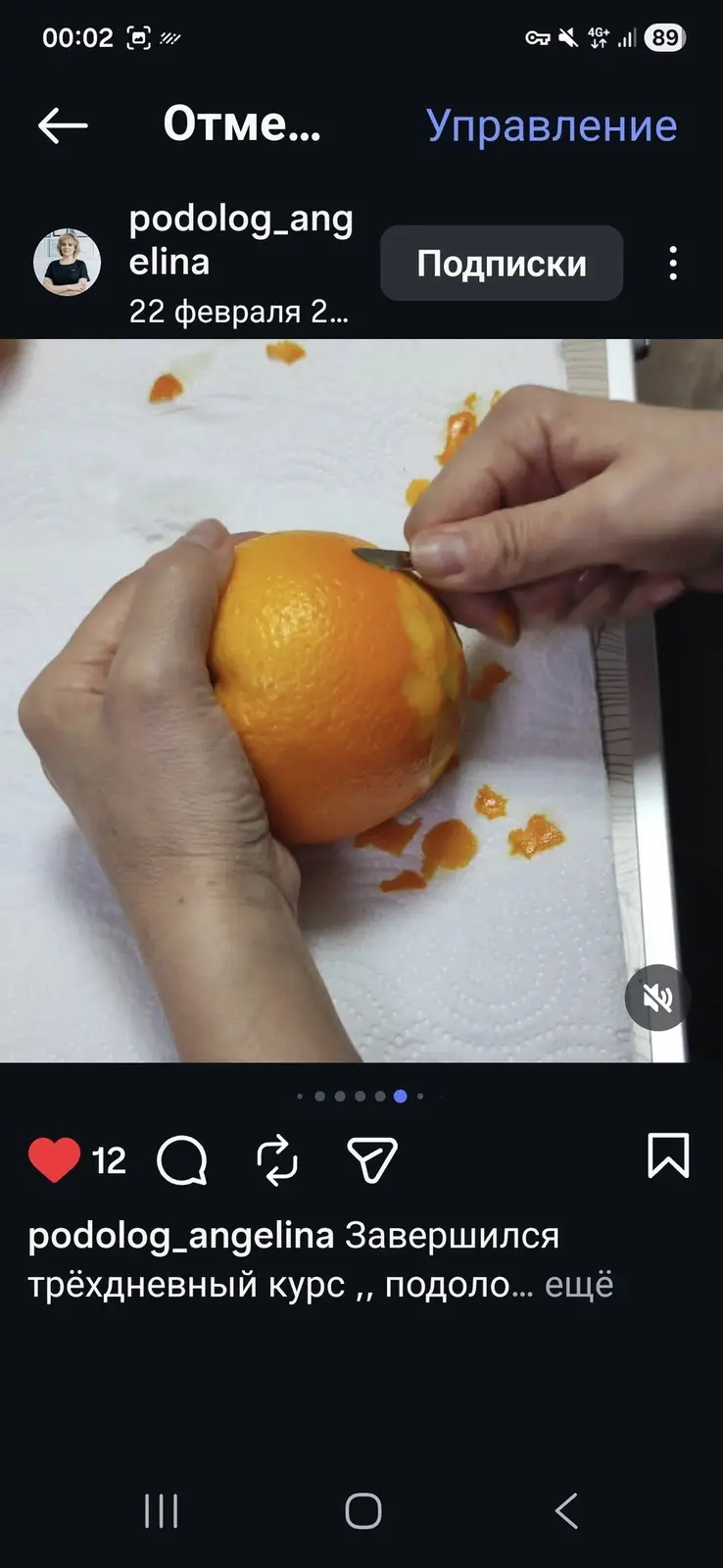 Профессиональные услуги подолога — фото 4