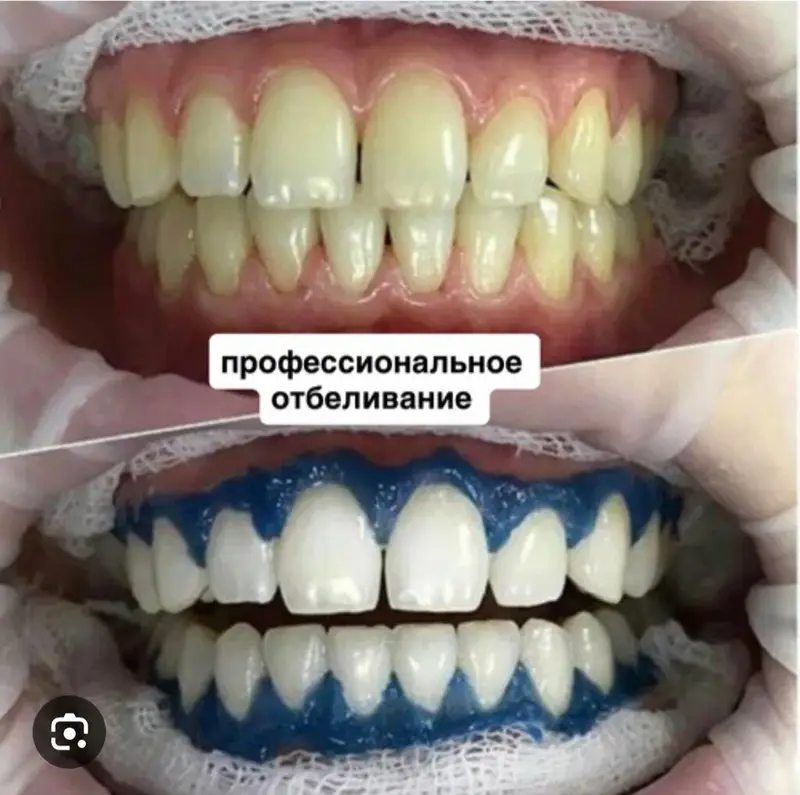 Стоматологические услуги Dental Plus Специализация — фото 3