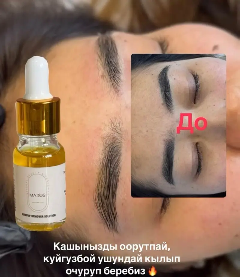 АКЦИЯ !АКЦИЯ! УДАЛЕНИЯ БРОВЕЙ Новый метод удаления Сейчас по акции — фото 2