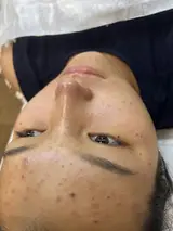 Косметология, Чистка кожи, Консультация