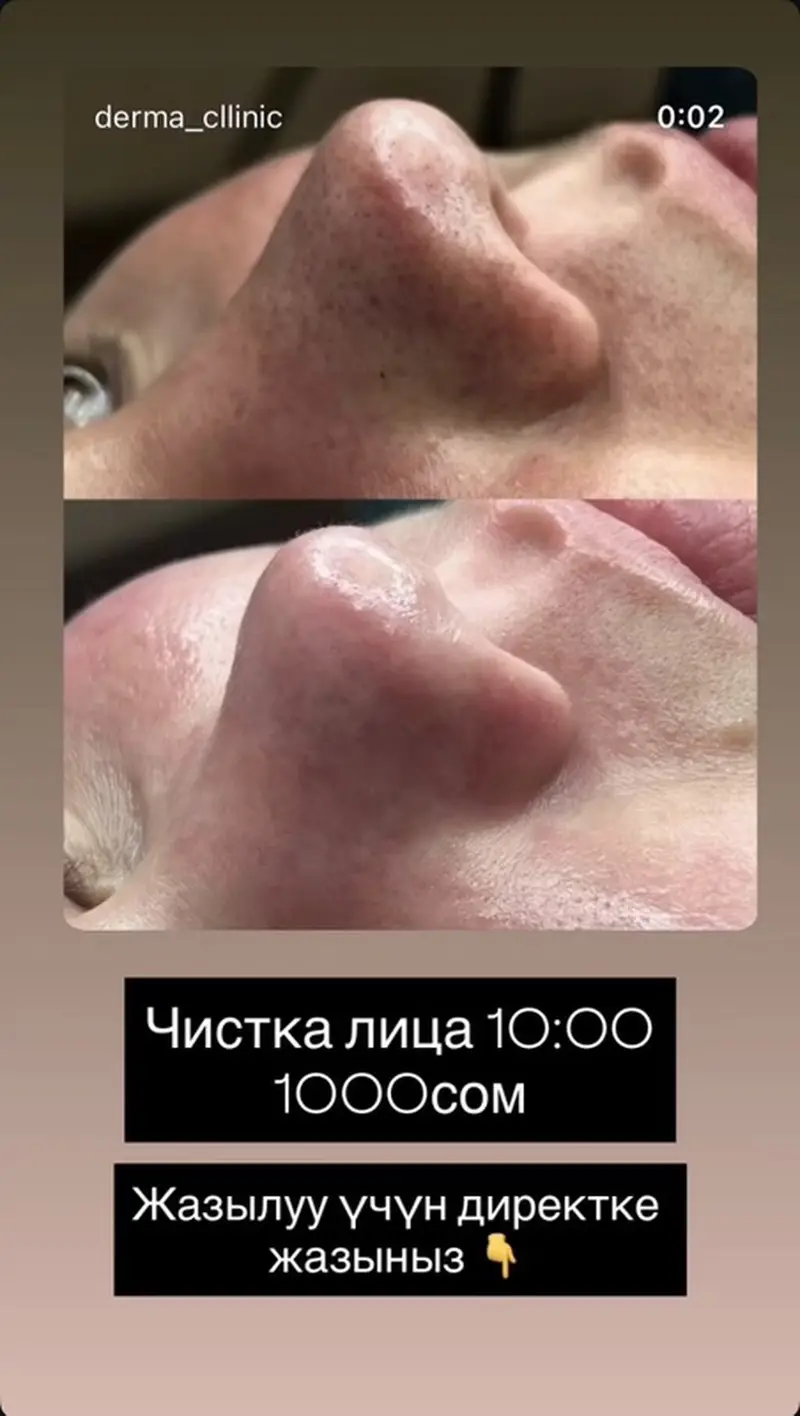 Косметология, Чистка кожи, Консультация — фото 2