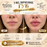 Контурная пластика губ гиалуроновым филлером.