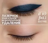 Лазерное удаление перманентного макияжа и татуажа