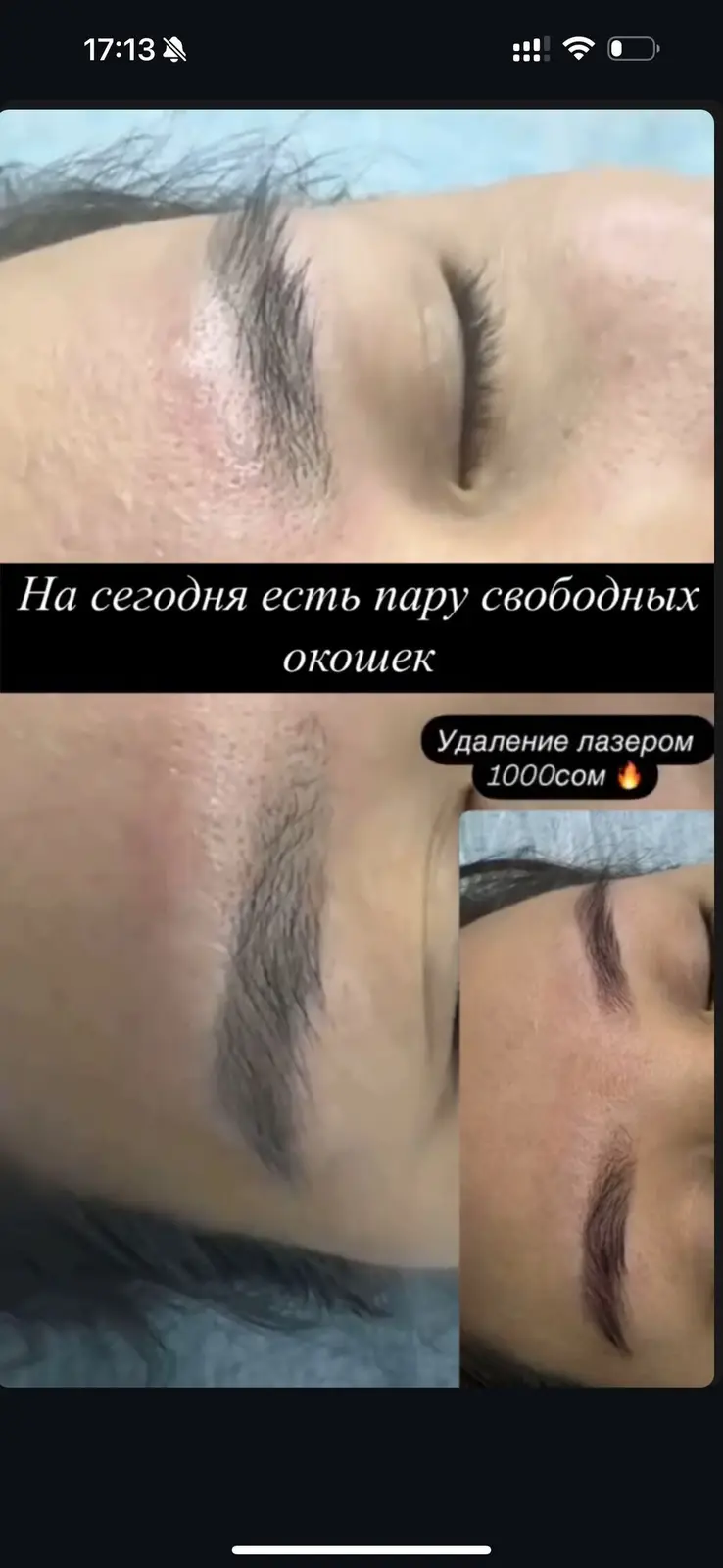 АКЦИЯ !АКЦИЯ! УДАЛЕНИЯ БРОВЕЙ Новый метод удаления Сейчас по акции — фото 6