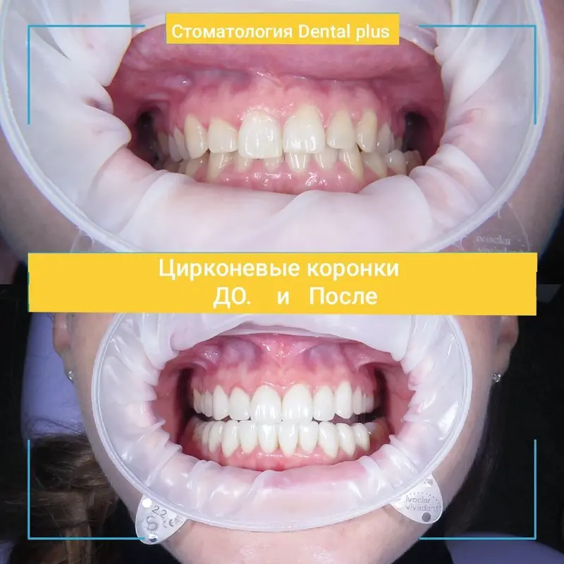 Стоматологические услуги Dental Plus Специализация — фото 2