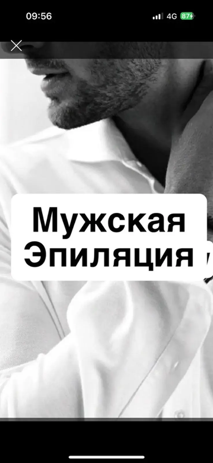 Мужская эпиляция (шугаринг) Услуги по удалению нежелательных волос — фото 2